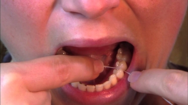 Ispolzovaniye zubnou niti