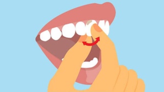 podvizgnost zubov