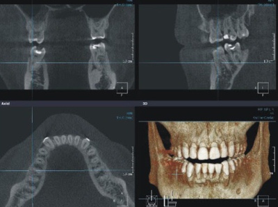 diagnostika v ortodontii