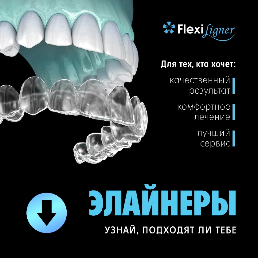 Элайнеры Flexiligner в Москве Установка Элайнеров Flexiligner в Москве, узнайте, подходит ли вам такой вид ортодонтического лечения